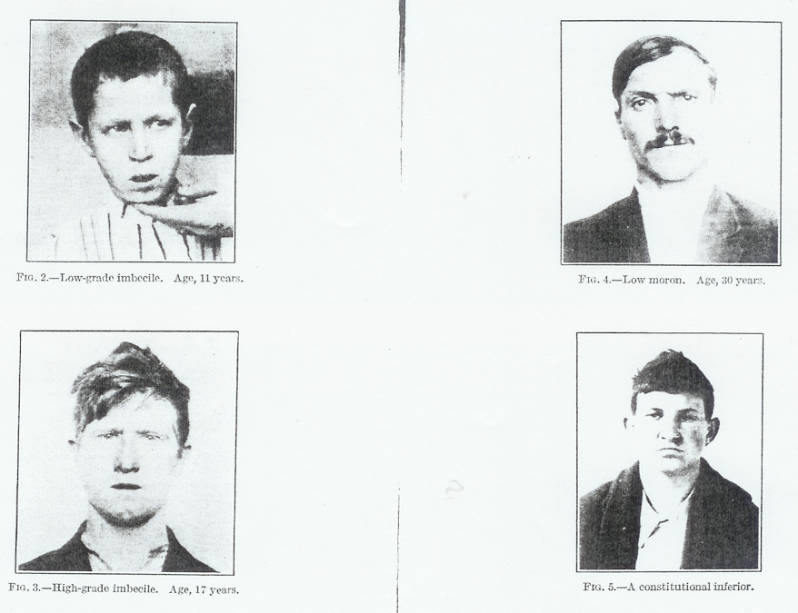 There are four black and white images of faces tiled and spaced evenly on a page. Gender has not been assigned to any of these images. In the top left image, there is an eleven-year-old with close-cropped hair, wearing a striped short, labeled a "low-grade imbecile," a hand reaching from out of the frame to hold up the chin, with eyes directed to our right; in the top right image, there is a twenty-year-old with a dark mustache, wearing a suit jacket, labeled "low moron"; in the bottom right image, a teenager wearing a heavy coat is pictured, labeled "a constitutional inferior"; in the bottom left image there is a seventeen-year-old with blond hair, labeled a "high-grade imbecile." 